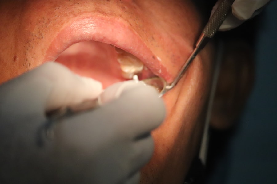 orthodontic treatment duration