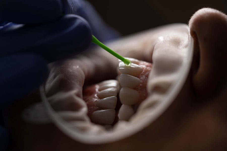 Photo oral health