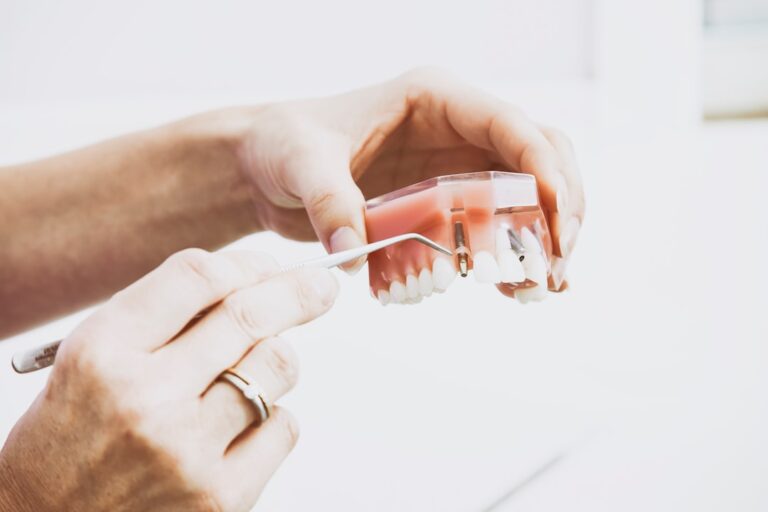 Photo Invisalign orthodontic treatment