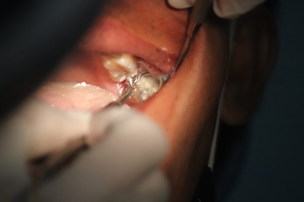 Photo orthodontic treatment cost