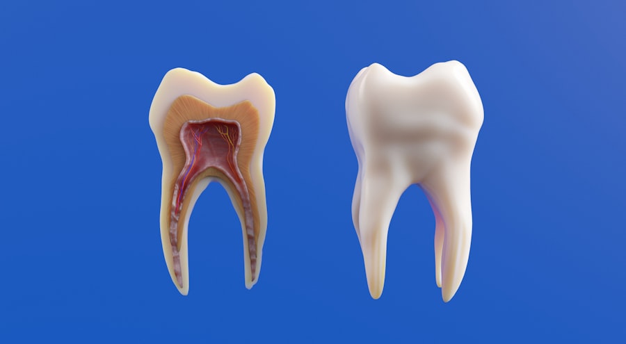 Photo orthodontic treatment duration